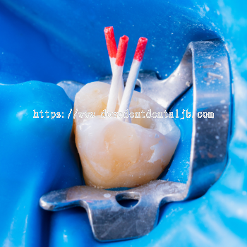 Terapi Endodontik