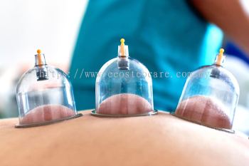 Acute Cupping Therapy