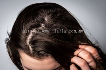 Oily Hair Scalp Treatment