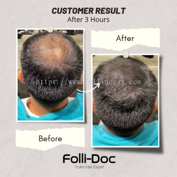 Hair Growth Service