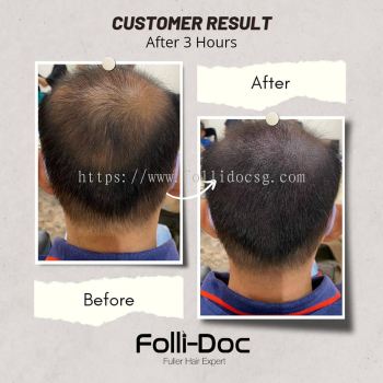 Hair Follicle Service