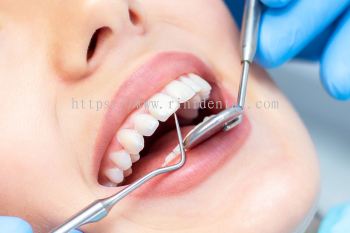 Routine Dental Check Up