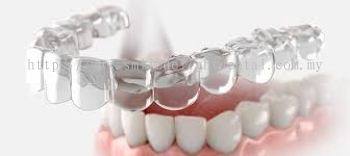 Clear Aligners