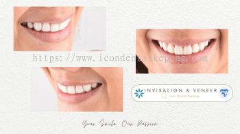 Invisalign