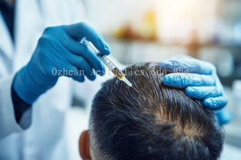 Scalp Platelet Rich Plasma (PRP)