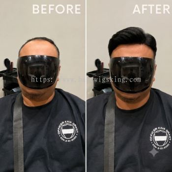 Premium Elite Wig Before & After | Hair Wigs King Malaysia