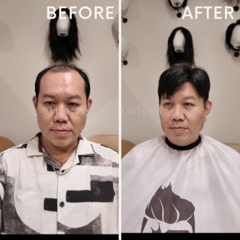Invisible Hair Wig Transformation | Hair Loss Solution in Kuala Lumpur, Selangor, Johor & Singapore
