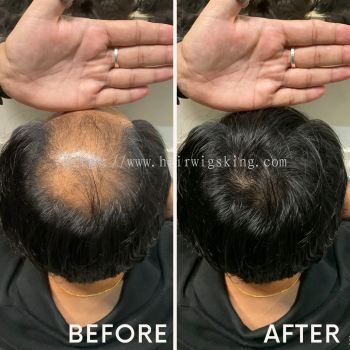 Natural Looking Invisible Hair Wig Before & After | Hair Wigs King Malaysia